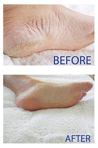 Smith's Amish Foot Cream (4 oz.) Deep Soothing Herbal Cream for Intense Foot and Leg Discomfort including Burning, Cramping and Restlessness Sensations