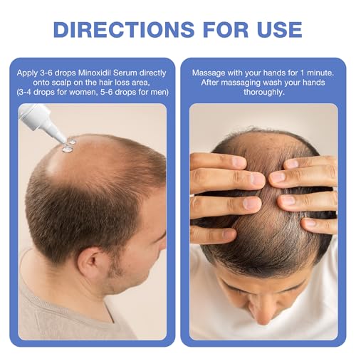 5% Minoxidil for Men Hair Growth Serum - Minoxidil for Women Serum with Biotin for Thicker & Healthier, Topical Minoxidil for Men Restore Fuller Beard