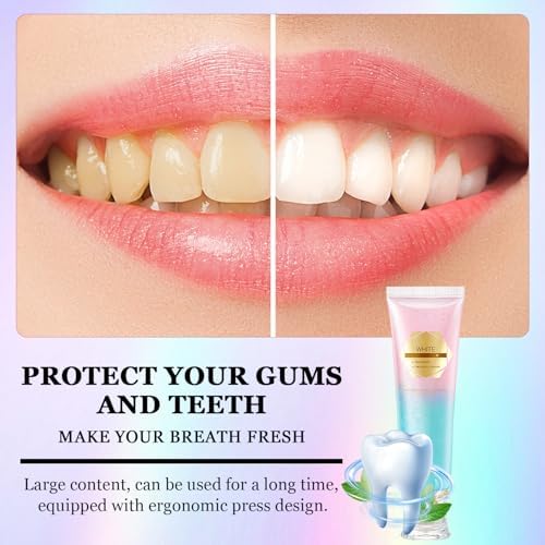 Acssart Radiant Whitening Toothpaste, Niacinamide Whitening Toothpaste, Niacinamide Dazzling Toothpastes White, Teeth Whitenings Toothpastes, Fresh Breath Tooth Paste, Remove Tooth Stains(2pcs