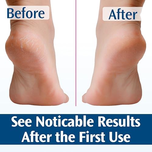 PediFix Deep-healing Foot Cream, 4 Oz