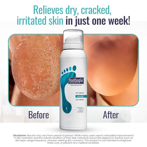 FOOTLOGIX DD Cream Mousse, White, 4.23 Ounce