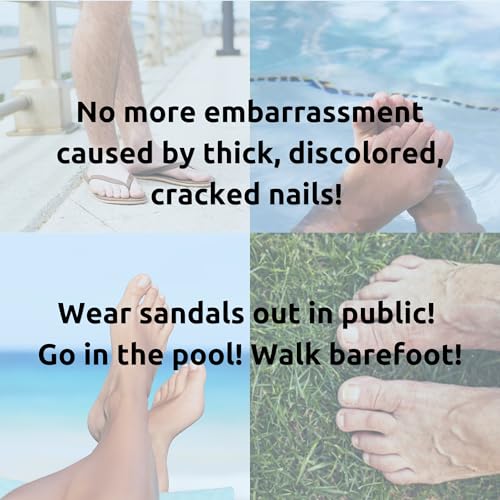 Nail Renewal Gel, Discoloration, Thick, Brittle, Cracking Nails, Clippers Included - 1.25 fl. oz.