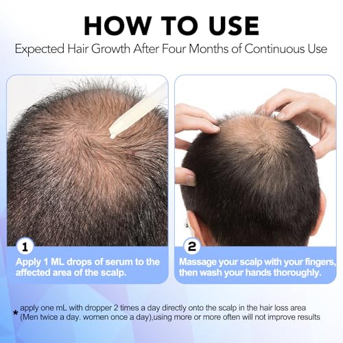 Minoxidil for Men-5% Extra Strength Hair Regrowth for Men Treatment-5% Topical Solution-Dropper Applicator Included -Minoxidil for Women-Stop Thinning & Hair Loss (1pcs