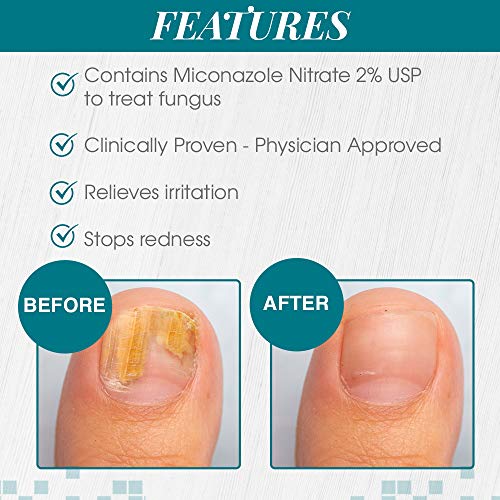 Nail Tek Maximum Strength Solution for All Nail Types, Clinically Proven, 0.33 oz, 1-Pack