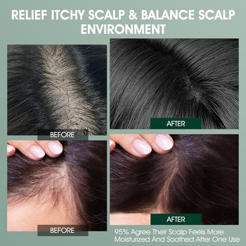 Scalp Treatment, Rosemary Refreshing Scalp Treatment with Tea Tree, Clarifying Build Up & Purifying, Leave-In Scalp Detox for Dry Itchy Scalp,Vegan & Cruelty-Free,120ML