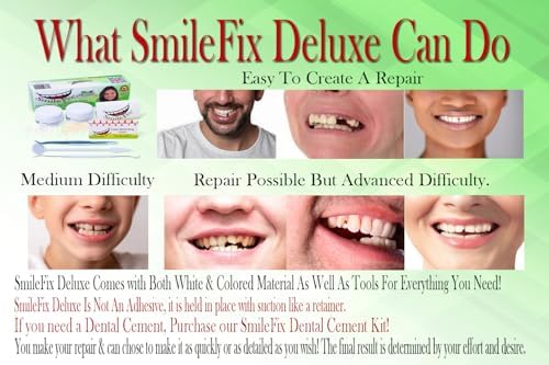 SmileFix Deluxe Dental Repair Kit - Color Matching Compound - Includes Tools - Missing Or Damaged Teeth - Fix Gaps, Broken Teeth - Durable Tooth Repair - Fast & Easy Process