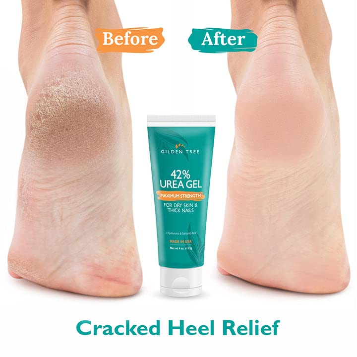 GILDEN TREE Urea Gel 42 Percent For Feet Maximum Strength Softens Cracked Heel Calluses & Thick Toenails
