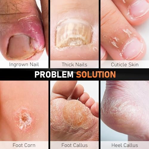 7PCS Ingrown Toenail Removal Kit, Professional Pedicure Tools for Feet, Toe Nail Clippers & Pedicure Knife Set with Corn Removers, Foot Scraper, Callus Shaver, Calloused Feet, Cuticle Remover Tool