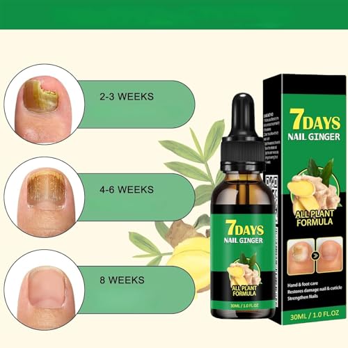 7 days Nail Growth Serum, 2PCS 7 Days Ginger Nail Essence, Multi-Purpose Nail Repair, Nail Nutrient Oil Strengthener Oil (2pcs)