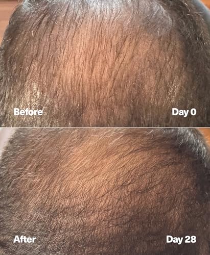 PowerCycle Exosome Scalp Serum – Exosomes for Hair Regrowth, NX35 Growth Serum, Hair Thickening Treatment for Women and Men, Lightweight Leave-In Formula, 60 mL