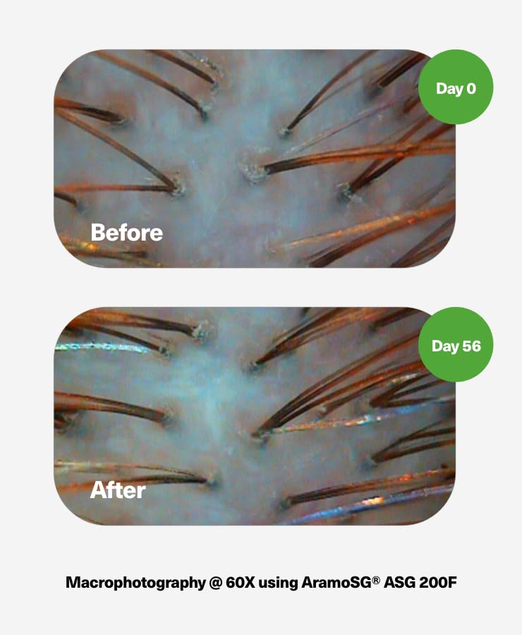 PowerCycle Exosome Scalp Serum – Exosomes for Hair Regrowth, NX35 Growth Serum, Hair Thickening Treatment for Women and Men, Lightweight Leave-In Formula, 60 mL