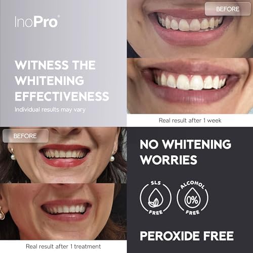 Natural Teeth Whitening Strips Kit 14 Treatments - Sensitive Teeth Whitener, Peroxide Free, Enamel Safe White Strips - Instant Teeth Whitening Without The Harm (28 Strips)