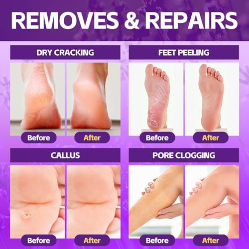 Pedicure Foot Soak, Foot Spa Soak, Pedicure Kit, Bubble Foot Bath For Tired & Dry Cracked Feet, Athletes Feet, Odor Foot and Softens Calluses, Foot Soak 16 Packs A Box, Lavender
