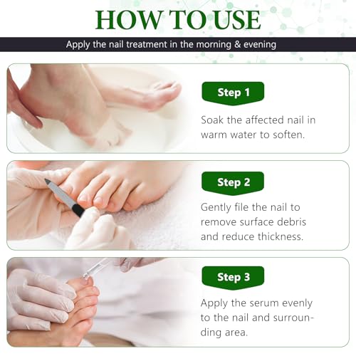 7 Days Nail Fungus Treatment, Fungi Nail Liquid Maximum Strength, Ginger Cuticle Care Oil for Strengthen & Promote Nail Growth (2PCS)