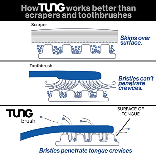 Peak Essentials | TUNG Tongue Gel | Mint Blast Natural Tongue Cleaning Paste | Bad Breath and Halitosis | Mouth Odor Eliminator | Fight Bad Breath | BPA Free | Made in America (2 PACK)