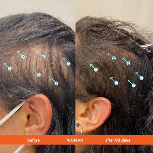 DS Labs Revita Shampoo – High-Performance Hair Density Shampoo, Volumizing & Thickening, Fuller, Healthier-Looking Hair, Sulfate & Silicone Free, For Men & Women, 925mL, Packaging May Vary