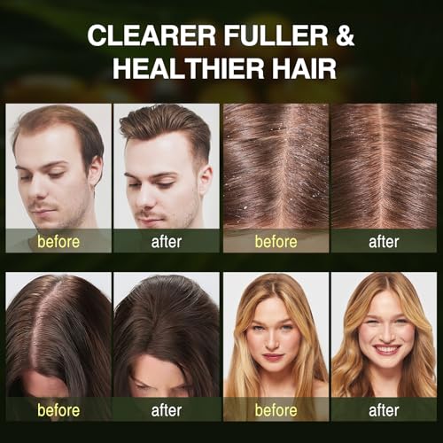 Batana Oil Hair Growth Shampoo, Strengthening Regrowth Shampoo for Men & Women with Thinning Hair & Hair Loss, Infused Rosemary, Mint Oil Nourishes Scalp, Sulfate Free for All Hair Types, 10.15 fl.oz