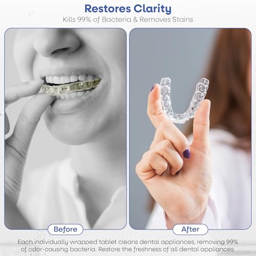 Dr. Taylor’s Retainer Cleaner Tablets for Aligners & Dentures - Effectively Removes Stains, Plaque, and Odor - Mouth & Night Guards Cleaner with Refreshing Mint Flavor - 120 Tablets