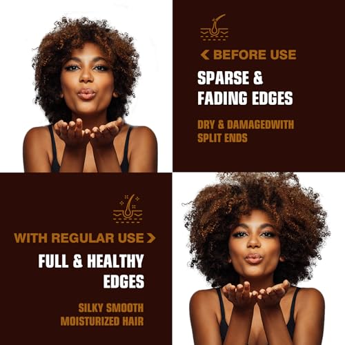 Organic Batana Oil for Hair Growth & Repair | 100% Pure, Unrefined Hair Treatment | Strengthens, Moisturizes, Reduces Hair Fall | 4.15 oz