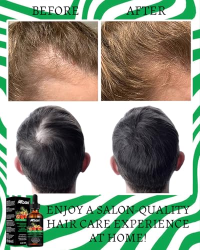 Batana Oil for Hair Growth, with Rosemary Oil Maca Argan Jojoba Oil, Promotes Hair Thickness, Nourish Scalp and Hair for All Hair Tapes | Glass Bottle with Dropper | 1fl oz + 1 fl oz