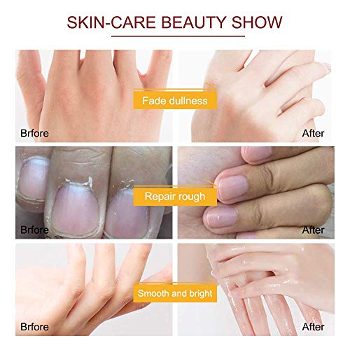 Hand Mask, 5 Pairs Hand Moisturizing Gloves Repairing Hand Mask for Extra Dry Skin Spa Masks, Exfoliating Hand Peeling Mask, Repair Rough Skin for Men & Women