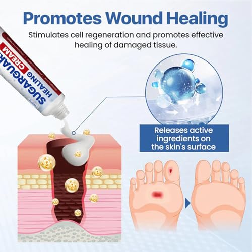 Sugar Guard Healing Cream,Healthy Feet Cream,Foot Care - Keep Feet Healthy (1)