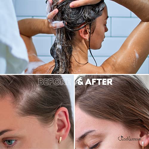 Hair Loss Shampoo | Hair Regrowth Shampoo For Thinning Hair | Hair Growth Product For Men and Women | Just Nutritive | 16 Oz