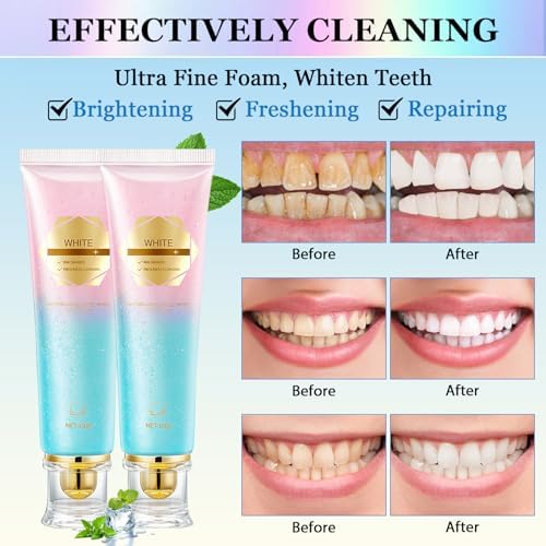 Acssart Radiant Whitening Toothpaste, Niacinamide Whitening Toothpaste, Niacinamide Dazzling Toothpastes White, Teeth Whitenings Toothpastes, Fresh Breath Tooth Paste, Remove Tooth Stains(2pcs