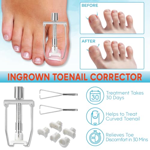 Ginger Ingrown Toenail Treatment, Professional Ingrown Toenail Removal Kit at Home, Ingrown Toenail Tool with Ingrown Toenail Corrector, Corrector Patch, Toenail Clipper, Nail File Lifter