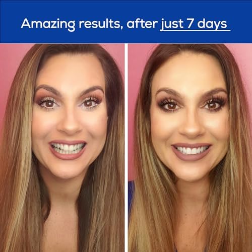 GLO Science Teeth Whitening Gel – 6% Hydrogen Peroxide – Clinically Proven, Fast & Safe for Sensitive Teeth – Includes 10 Gel Vials & 1 Lip Care