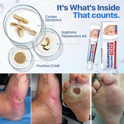 Sugar Guard Healing Cream,Healthy Feet Cream,Foot Care - Keep Feet Healthy (1)
