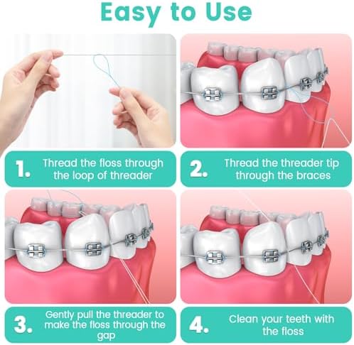 Floss Threaders, 400 Count Threaders for flossing, Dental Floss Threader for Braces, Bridges, Implants, Permanent Retainer (Pack of 4)