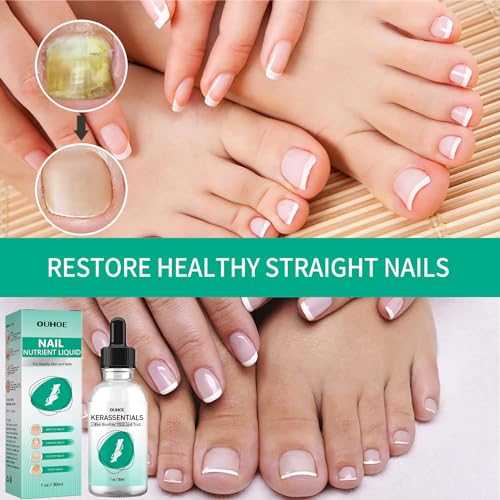 Kerassentials Toenail Oil, Kerassentials Nails colourless (3PCS)