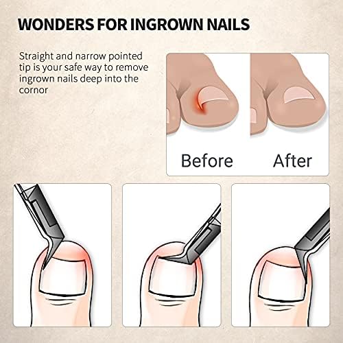 FERYES Toenail Clipper Straight Blade for Ingrown and Thick Nails - Stainless Steel and Sharp Pointed Tip Ingrown Nail Clipper – Wide Jaw Toe Nail Cutter Podiatry Tool Dark Gray