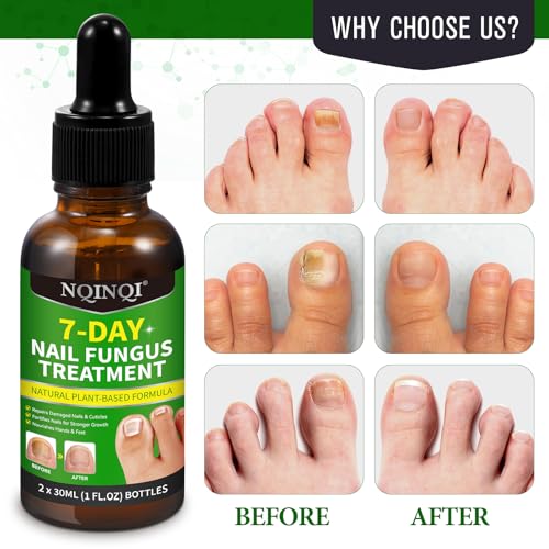 7 Days Nail Fungus Treatment, Fungi Nail Liquid Maximum Strength, Ginger Cuticle Care Oil for Strengthen & Promote Nail Growth (2PCS)