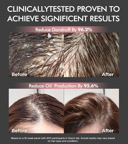 Tripeptide-Infused Hair Growth Biotin Shampoo and Conditioner Set, Onion Anti-Loss Volumizing Moisturizing Treatment for Soft Shine Hair, Rosemary Clarifying Dandruff Shampoo for Women Men, 2 x 16.9oz