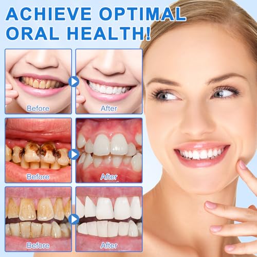 9.9% Hydroxyapatite Toothpaste 2 Pack, Nano Hydroxyapatite Toothpaste Protects Enamel and Strengthens Teeth, Cleans and Cares for Oral Health, Promotes Freshens Breath