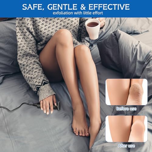 Dermave Electric Foot Callus Remover, Electric Callus Remover Feet, Callus Remover for Feet - Foot Filer with 60pcs Sanding Discs for Dead Cracked Skin, Men/Women (Black)