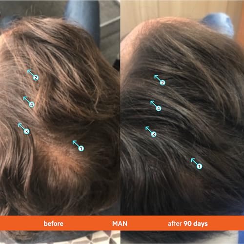 DS Labs Revita Shampoo – High-Performance Hair Density Shampoo, Volumizing & Thickening, Fuller, Healthier-Looking Hair, Sulfate & Silicone Free, For Men & Women, 925mL, Packaging May Vary