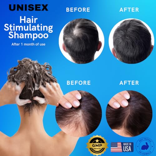 Minoxidil Shampoo – Sulfate-Free with Keratin & Collagen – Deep Cleansing & Nourishing Formula for Fuller, Thicker-Looking Hair – Unisex – 32oz (950ml)