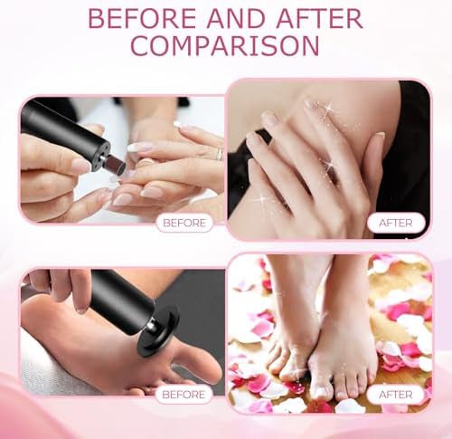 Ranrose Electric Foot Callus Remover: Rechargeable Electric Callus Remover for Feet, 2 in 1 Foot File Pedicure Tools with 20 Sandpaper Discs and 20 Nail Drill Bits, 6 Adjustable Speeds
