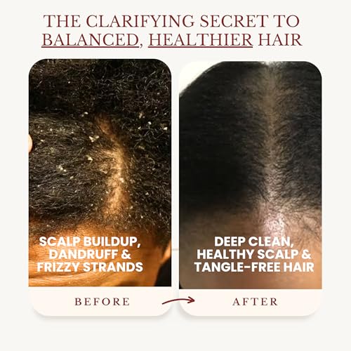 Apple Cider Vinegar Shampoo and Conditioner Set, Deep Cleans, Clarifies, Detoxes Scalp & Hair, Balances pH, Botanical, Sulfate & Paraben Free, 16 fl oz Each