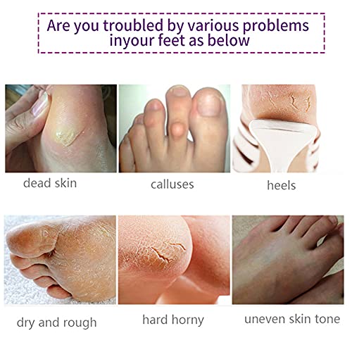 Foot Peel Mask 5 Pack,Lavender Exfoliating Foot Masks, Soft Smooth Touch Natural Exfoliator for Dry Dead Skin, Callus, Repair Rough Heels,Gifts for Women Mom and Men