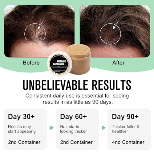 Divine Vitals Batana Oil for Hair Growth, Adds Texture & Shine, For Men and Women (2pcs)