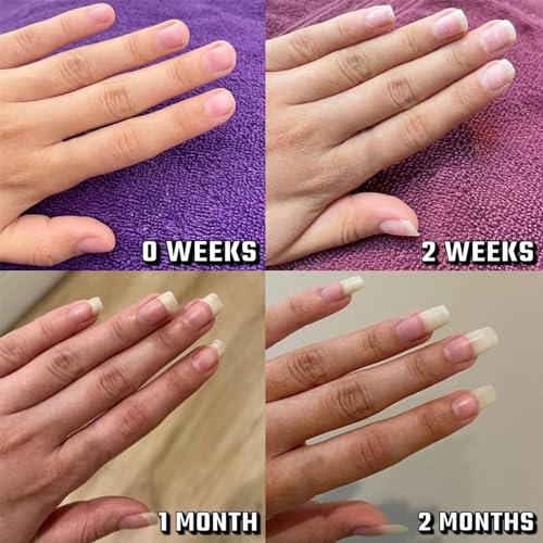 Radiant Nail Growth Oil, Nail Strengthener, Cuticle Oil for Nails, For Moisturize Strengthen Nail Care Oil, Finger Edge Manicure Nourishing Pen, Anti-hangbnail removal, Nail Skin Edge Care