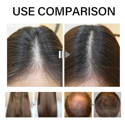 Deoxyribose Sugar Hair Growth Serum | Scalp Treatment for Thicker, Stronger Hair | Reduces Hair Loss | Nourishes with Green Tea & Ginseng Extract (1PCS)