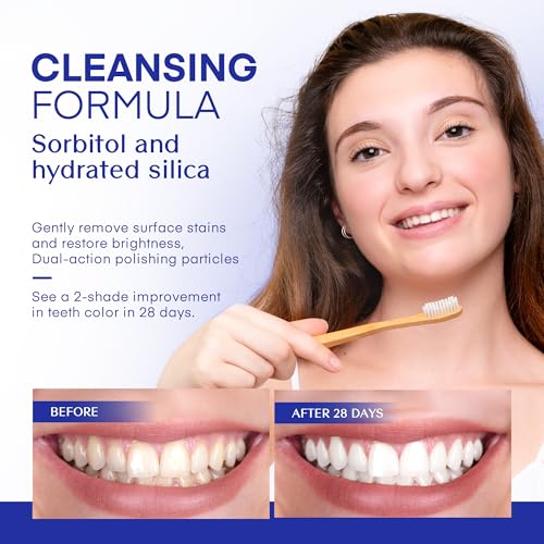 PearlSmile Hydroxyapatite Niacinamide Whitening Toothpaste – 5% Niacinamide + 10% Nano-Hydroxyapatite (nHAp) – Strengthens Enamel & Remineralizes – Fluoride-Free, 4.2oz (Pack of 1)