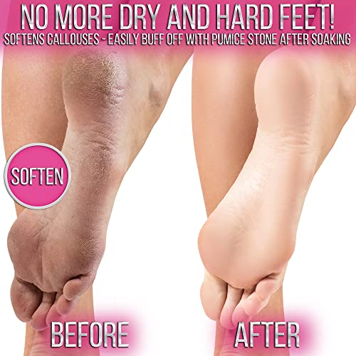 SOO Jelly Pedicure Packs - Pedicure Foot Soak For Feet - Moisturizing Jelly Spa Pedi Soak - Foot Spa Bath Soak For Soaking - Pedicure Foot Gel To Relax Sore Feet (Damascus Rose)