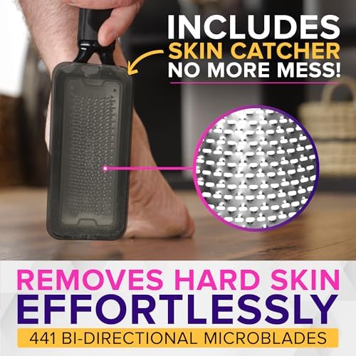 RUSTPROOF Foot File Callus Remover for Feet with Skin Catcher (XL Size) NYK1 MEGAFILE Foot Callus Remover for Wet & Dry Use - High-Performance Feet Scrubber with Textured Grip for Non-Slip Control