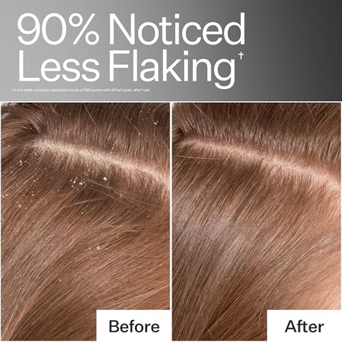 ACT+ ACRE Cold Processed Scalp Detox Oil - Sulfate-Free Care for Flaky, Dry and Itchy Scalp - Promotes Thicker, Fuller-Looking Hair